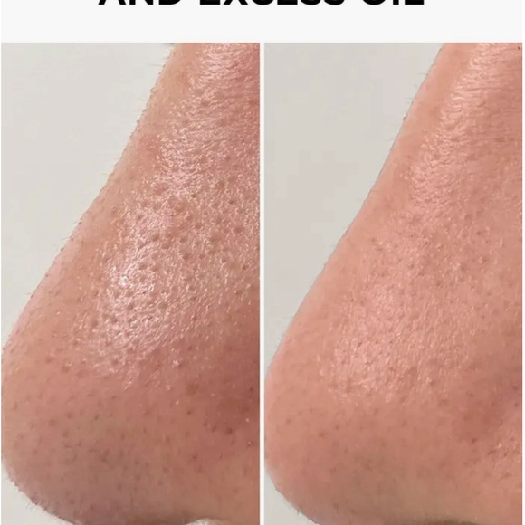 Beauty Bio pore cleansing system NIB - Picture 5 of 6